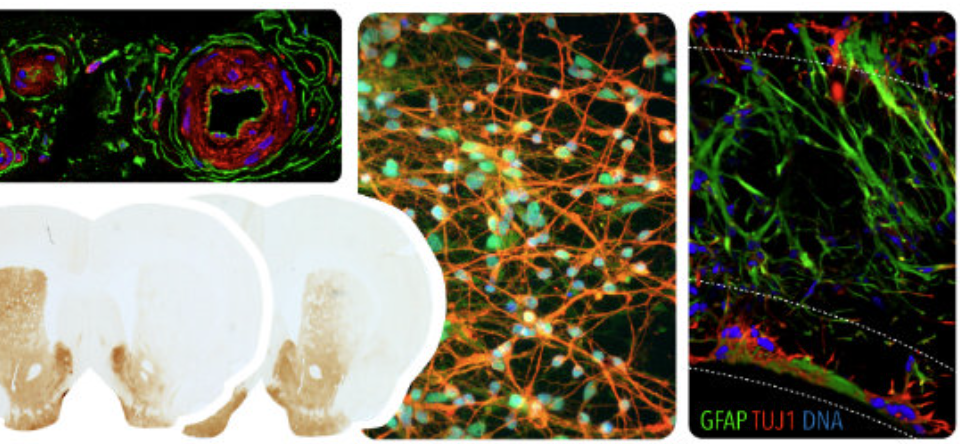 Stem Cells and Regeneration masters course University of Bristol